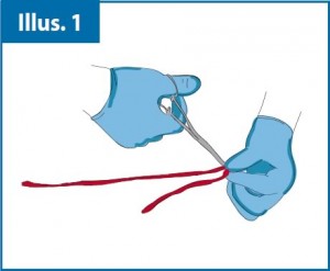 cord_blood_collection_fig-01