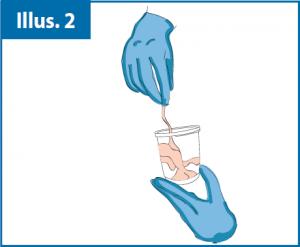 cord_blood_collection_fig-02