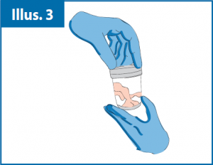 cord_blood_collection_fig-04